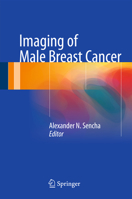 Imaging of Male Breast Cancer 331906049X Book Cover
