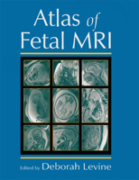 Atlas of Fetal MRI 0824725484 Book Cover
