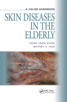 Skin Diseases in the Elderly: A Colour Handbook 1840761547 Book Cover