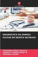 Diagnóstico Da Doença Pulpar Em Dentes Decíduos (Portuguese Edition) 6206519635 Book Cover