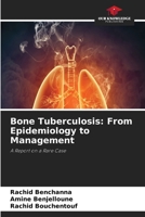 Bone Tuberculosis: From Epidemiology to Management 663004830X Book Cover