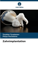 Zahnimplantation (German Edition) 6208510058 Book Cover