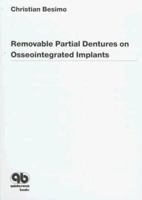 Removable Partial Dentures on Osseointegrated Implants 0867153296 Book Cover