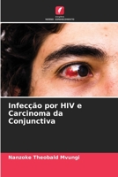 Infec��o por HIV e Carcinoma da Conjunctiva 6205336642 Book Cover