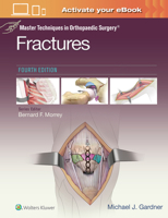 Mtos : Fractures 4 1975139402 Book Cover