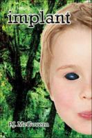 implant 1413769527 Book Cover