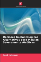 Decisões Implantológicas Alternativas para Maxilas Severamente Atróficas (Portuguese Edition) 620808489X Book Cover