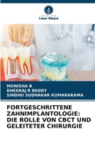 Fortgeschrittene Zahnimplantologie: Die Rolle Von Cbct Und Geleiteter Chirurgie (German Edition) 6630205707 Book Cover