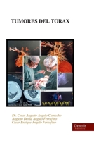 TUMORES DEL TORAX (Spanish Edition) B0GYT7FJZG Book Cover