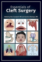Essentials of Cleft Surgery 1543912095 Book Cover