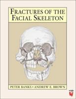 Fractures of the Facial Skeleton 0723610347 Book Cover
