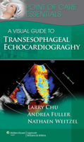 A Visual Guide to Transesophageal Echocardiography 145112788X Book Cover