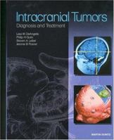 Intracranial Tumors of the Central Nervous System 1901865371 Book Cover