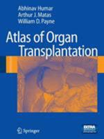 Atlas of Organ Transplantation 1848009143 Book Cover