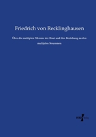 Über die multiplen Fibrome der Haut und ihre Beziehung zu den multiplen Neuromen 3743420244 Book Cover