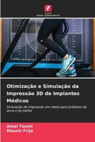 Otimização e Simulação da Impressão 3D de Implantes Médicos (Portuguese Edition) 6208265576 Book Cover