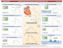 MemoCharts Pharmacology: Drug therapy for cardiac arrhythmias (Review chart) 1595410244 Book Cover