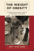 The Weight of Obesity: Hunger and Global Health in Postwar Guatemala 0520286820 Book Cover