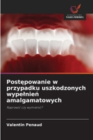 Postepowanie w przypadku uszkodzonych wypelnien amalgamatowych (Polish Edition) 6630557808 Book Cover