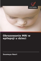 Obrazowanie MRI w epilepsji u dzieci (Polish Edition) 6209960839 Book Cover
