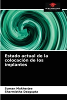 Estado actual de la colocación de los implantes 6202846801 Book Cover