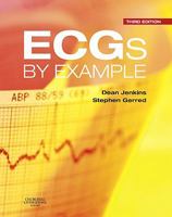 ECGs by Example 0702042285 Book Cover