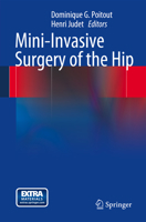 Mini-invasive surgery of the hip 2287799303 Book Cover
