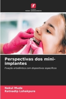 Perspectivas dos mini-implantes: Fixação ortodôntica com dispositivos específicos (Portuguese Edition) 6208780195 Book Cover