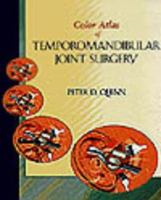 Color Atlas Of Temporomandibular Joint Surgery 0815145403 Book Cover