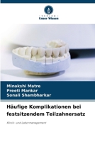 Häufige Komplikationen bei festsitzendem Teilzahnersatz (German Edition) 6207013646 Book Cover