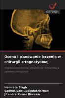 Ocena i planowanie leczenia w chirurgii ortognatycznej 6209316387 Book Cover
