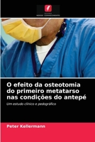 O efeito da osteotomia do primeiro metatarso nas condições do antepé 620275074X Book Cover