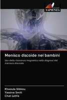 Menisco discoide nei bambini 6203127582 Book Cover