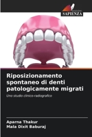 Riposizionamento spontaneo di denti patologicamente migrati 6204106279 Book Cover