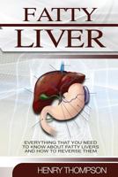 Fatty Liver: The Ultimate Step-By-Step Guide to Understanding and Reversing Fatty Liver Disease (Liver Cleanse, Nutrition, Liver Cleanse, Healthy Living, Revitalise Health, Detox Body, Weight) 154728725X Book Cover