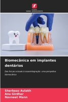 Biomecânica em implantes dentários (Portuguese Edition) 6630542355 Book Cover