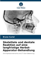 Skelettale und dentale Reaktion auf eine langfristige Herbst-Apparatur-Behandlung 6208653630 Book Cover
