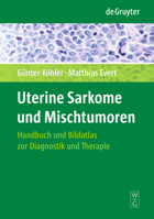 Uterine Sarkome und Mischtumoren: Handbuch und Bildatlas zur Diagnostik und Therapie 311021380X Book Cover