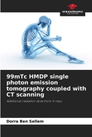 99mTc HMDP single photon emission tomography coupled with CT scanning: Additional radiation dose from X-rays 6206067599 Book Cover