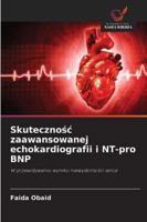 Skutecznosc zaawansowanej echokardiografii i NT-pro BNP (Polish Edition) 620895813X Book Cover