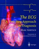 The ECG: A Two-Step Approach to Diagnosis 3540008691 Book Cover