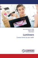 Lumineers: "Contact lenses for your teeth" 6202669160 Book Cover