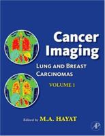 Cancer Imaging, Volume 1: Lung and Breast Carcinomas (Cancer Imaging) (Cancer Imaging) 0123704685 Book Cover