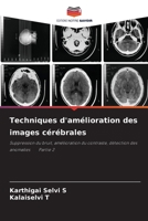 Techniques d'amélioration des images cérébrales: Suppression du bruit, amélioration du contraste, détection des anomalies Partie 2 6205841339 Book Cover