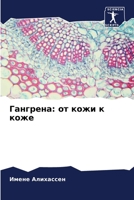 Гангрена: от кожи к коже 6205862840 Book Cover