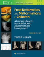 Foot Deformities and Malformations in Children: A Principles-Based, Practical Guide to Assessment and Management: Print + eBook with Multimedia 1975213378 Book Cover