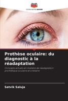 Prothèse oculaire: du diagnostic à la réadaptation 6630241207 Book Cover