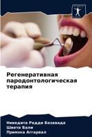 Регенеративная пародонтологическая терапия 6204078801 Book Cover