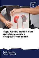 Поражение почек при тром 620580610X Book Cover