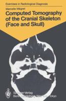 Computed Tomography of the Cranial Skeleton (Face and Skull): 58 Radiological Exercises for Students and Practitioners 3540153896 Book Cover